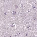 DNAH12 Antibody in Immunohistochemistry (IHC)