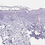 Triadin Antibody in Immunohistochemistry (IHC)