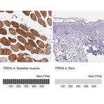 Triadin Antibody