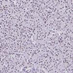 CEP72 Antibody in Immunohistochemistry (Paraffin) (IHC (P))