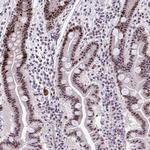 CEP72 Antibody in Immunohistochemistry (Paraffin) (IHC (P))