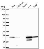 ACOT6 Antibody in Western Blot (WB)