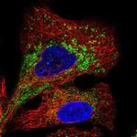 TMEM106B Antibody in Immunocytochemistry (ICC/IF)