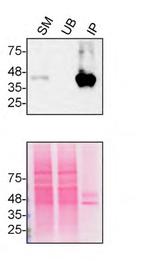 TMEM106B Antibody in Immunoprecipitation (IP)