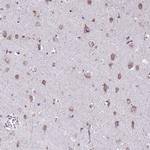 TMEM106B Antibody in Immunohistochemistry (IHC)