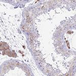 TMEM106B Antibody in Immunohistochemistry (IHC)