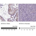 SETD1A Antibody in Immunohistochemistry (IHC)