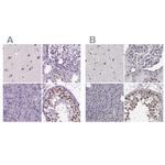 SETD1A Antibody in Immunohistochemistry (IHC)