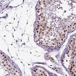 SETD1A Antibody in Immunohistochemistry (IHC)