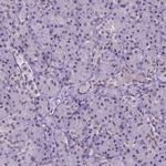 SETD1A Antibody in Immunohistochemistry (IHC)