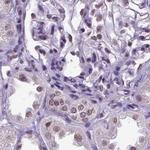 SETD1A Antibody in Immunohistochemistry (IHC)