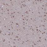 NUMBL Antibody in Immunohistochemistry (Paraffin) (IHC (P))