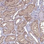 LIX1 Antibody in Immunohistochemistry (Paraffin) (IHC (P))