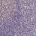 LIX1 Antibody in Immunohistochemistry (Paraffin) (IHC (P))