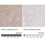 KIF21A Antibody in Immunohistochemistry (IHC)