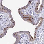 KIF21A Antibody in Immunohistochemistry (IHC)