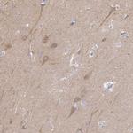 KIF21A Antibody in Immunohistochemistry (IHC)