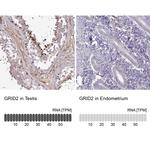 GRID2 Antibody in Immunohistochemistry (IHC)