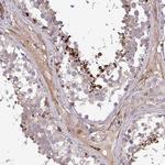 GRID2 Antibody in Immunohistochemistry (IHC)