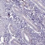 GRID2 Antibody in Immunohistochemistry (IHC)