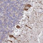 HMBOX1 Antibody in Immunohistochemistry (Paraffin) (IHC (P))