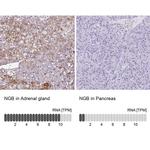 NGB Antibody in Immunohistochemistry (IHC)