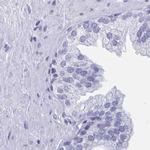 DPEP3 Antibody in Immunohistochemistry (IHC)