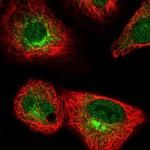 FUT10 Antibody in Immunocytochemistry (ICC/IF)