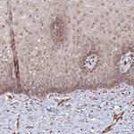 FUT10 Antibody in Immunohistochemistry (IHC)