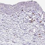 PTPLAD2 Antibody in Immunohistochemistry (IHC)