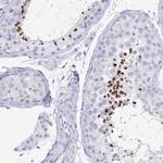 ZPBP Antibody in Immunohistochemistry (IHC)