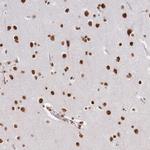 hnRNP U Antibody in Immunohistochemistry (Paraffin) (IHC (P))