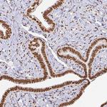 hnRNP U Antibody in Immunohistochemistry (Paraffin) (IHC (P))