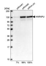 hnRNP U Antibody in Western Blot (WB)