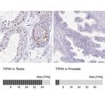 TIPIN Antibody in Immunohistochemistry (IHC)