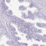 TIPIN Antibody in Immunohistochemistry (IHC)