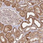 AACS Antibody in Immunohistochemistry (Paraffin) (IHC (P))