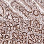 POLD3 Antibody in Immunohistochemistry (Paraffin) (IHC (P))