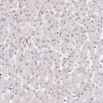 POLD3 Antibody in Immunohistochemistry (Paraffin) (IHC (P))