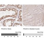 POLD3 Antibody in Immunohistochemistry (IHC)