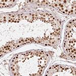 POLD3 Antibody in Immunohistochemistry (IHC)