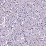 VGAT Antibody in Immunohistochemistry (IHC)