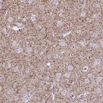 VGAT Antibody in Immunohistochemistry (IHC)