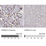 STARD13 Antibody in Immunohistochemistry (IHC)