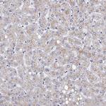 STARD13 Antibody in Immunohistochemistry (IHC)