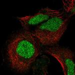 ADAT3 Antibody in Immunocytochemistry (ICC/IF)