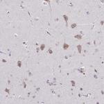 ADAT3 Antibody in Immunohistochemistry (Paraffin) (IHC (P))