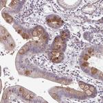 ADAT3 Antibody in Immunohistochemistry (Paraffin) (IHC (P))