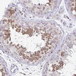 ADAT3 Antibody in Immunohistochemistry (Paraffin) (IHC (P))