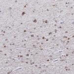 QDPR Antibody in Immunohistochemistry (Paraffin) (IHC (P))